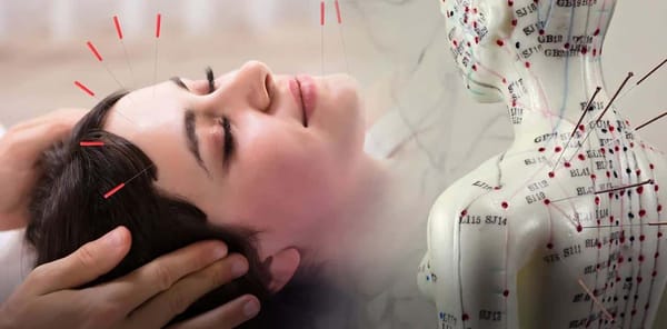 Fundamentos actuales de la terapia acupuntural